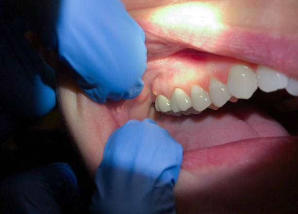 Best Broken or Cracked Tooth Emergency Dentist in Double Oak, TX