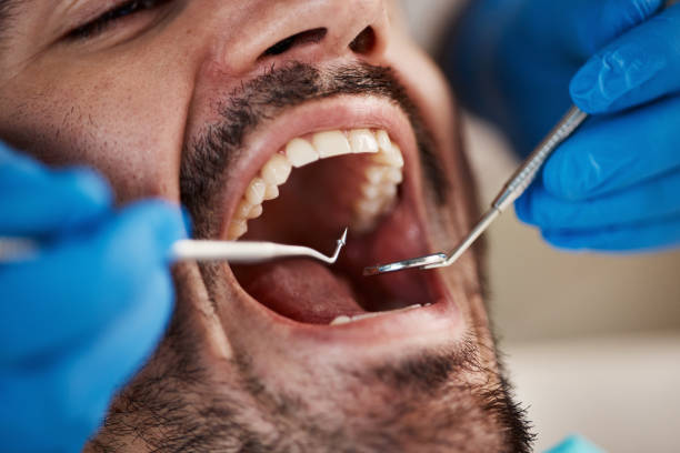 Best Emergency Dental Care for Abscessed Tooth in Double Oak, TX